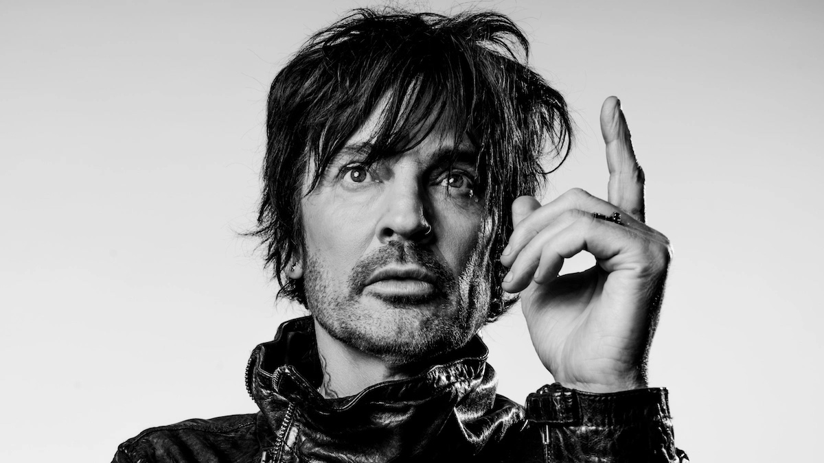 Tommy Lee Undergoes Gruesome-Looking Hand Surgery: “I Have My Life Back”