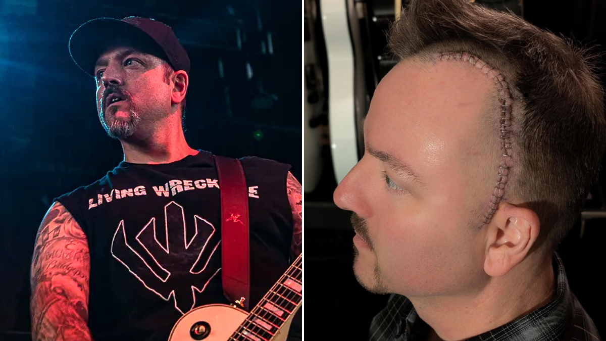 Wayne Lozinak de Hatebreed "s'améliorer chaque jour" après l'élimination de la tumeur du cerveau bénigne